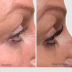 Obagi Nu-Cil Eyelash Enhancing Serum
