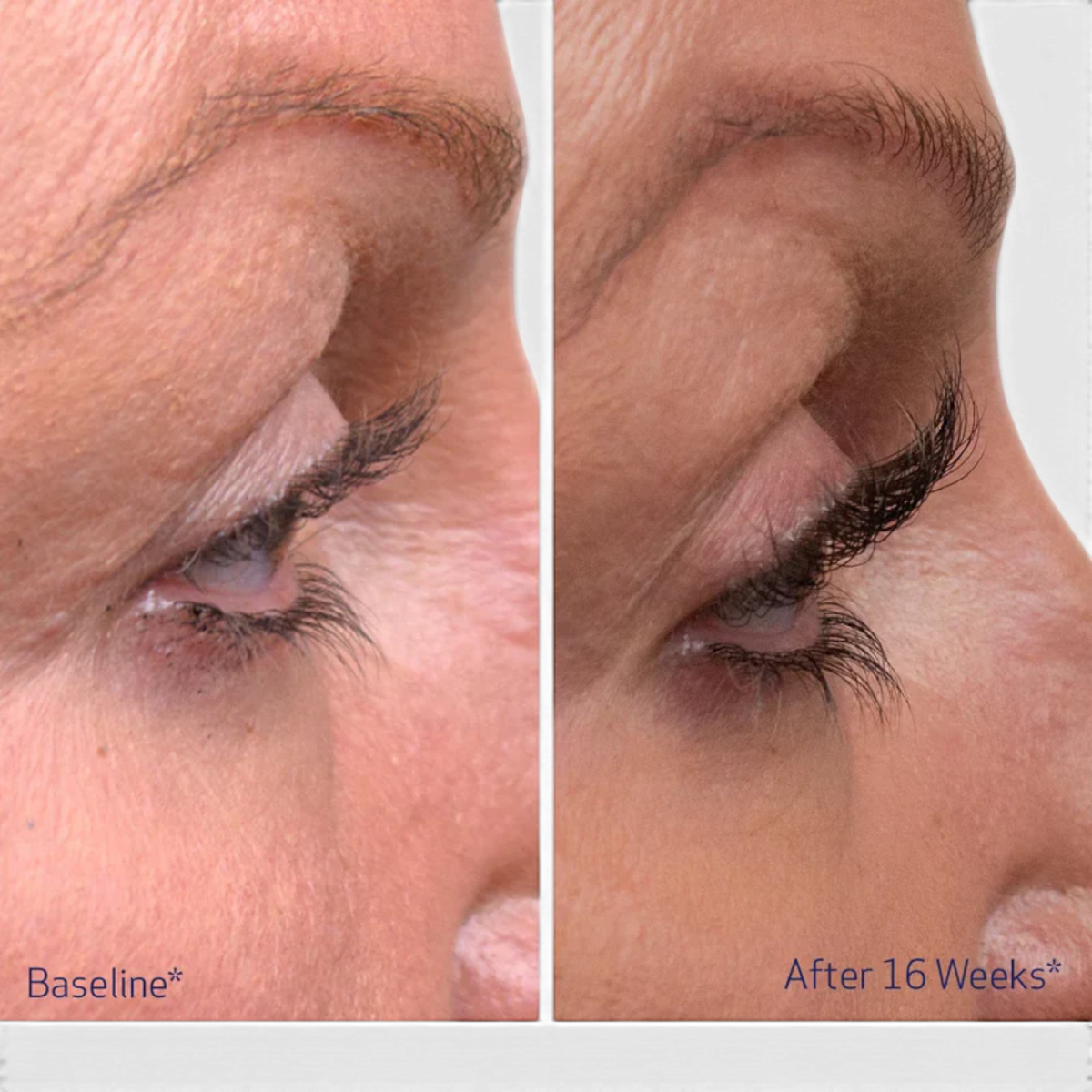 Obagi Nu-Cil Eyelash Enhancing Serum