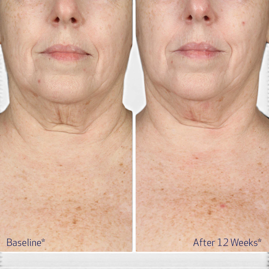 Obagi ELASTIderm Neck and Decollete Concentrate
