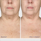 Obagi ELASTIderm Neck and Decollete Concentrate