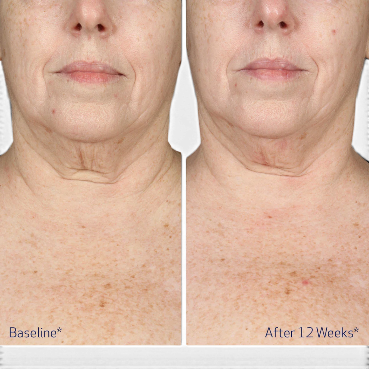 Obagi ELASTIderm Neck and Decollete Concentrate