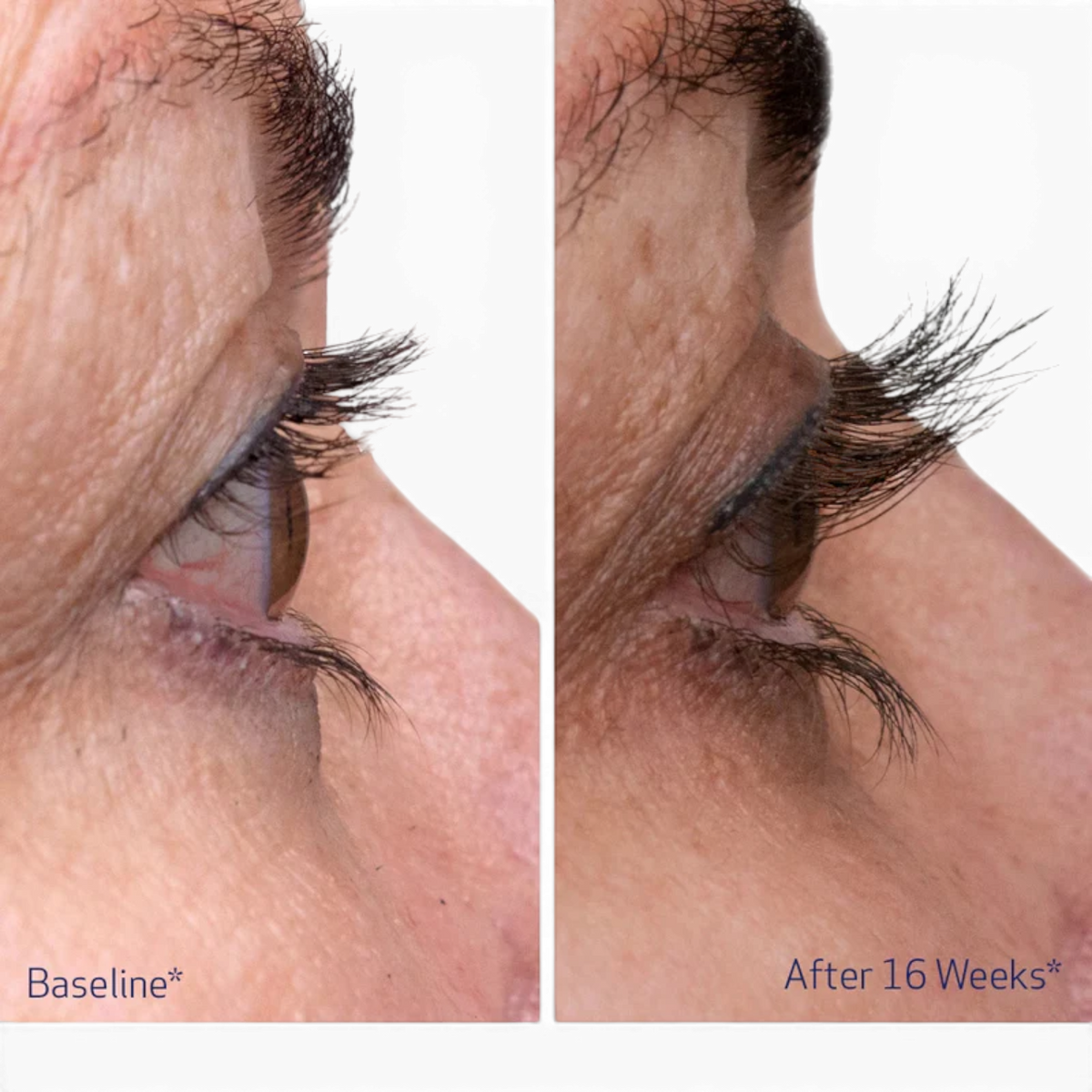 Obagi Nu-Cil Eyelash Enhancing Serum
