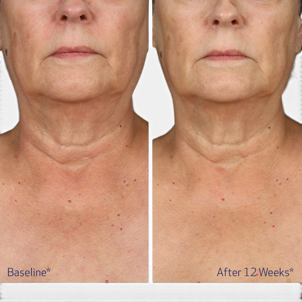 Obagi ELASTIderm Neck and Decollete Concentrate