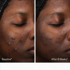 Obagi Retinol and PHA Refining Night Cream