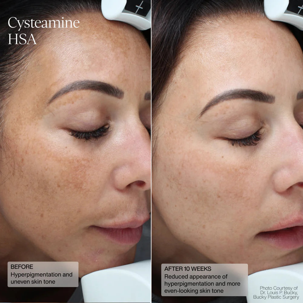 Senté Limited Edition Even Skin Tone Kit