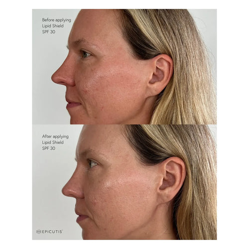 Epicutis Lipid Shield SPF 30 50ml product image