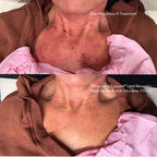 Epicutis Lipid Recovery Mask for Neck + Décolleté 5 x 20ml