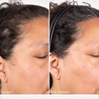 Obagi Nu-Cil BioStim Scalp Serum