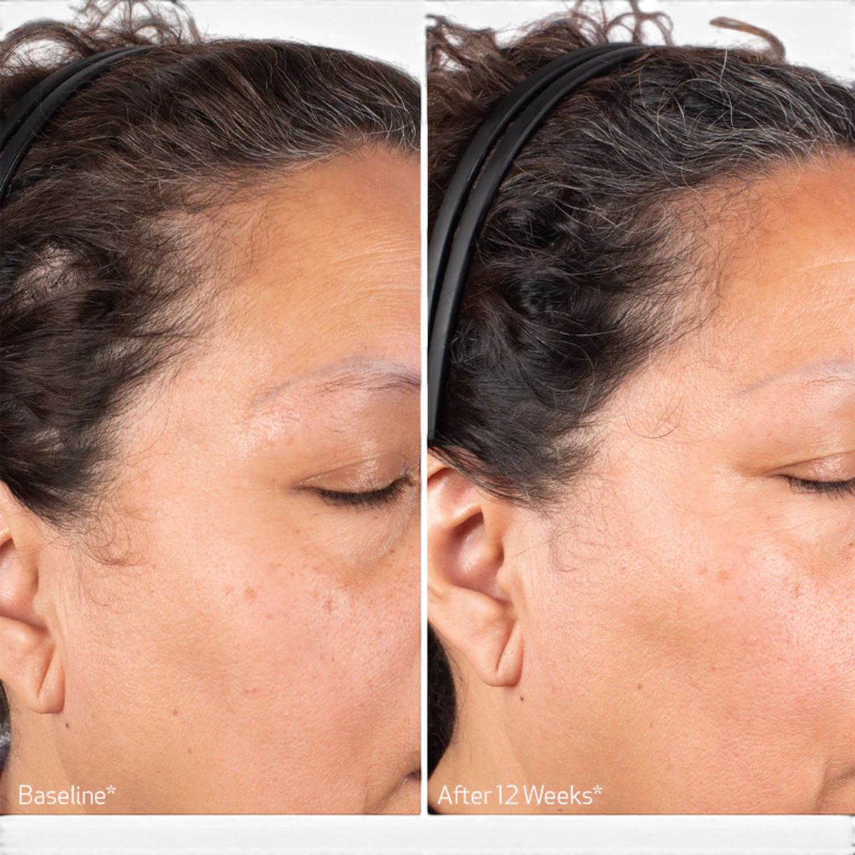 Obagi Nu-Cil BioStim Scalp Serum