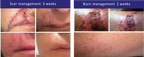iS Clinical SHEALD Recovery Balm