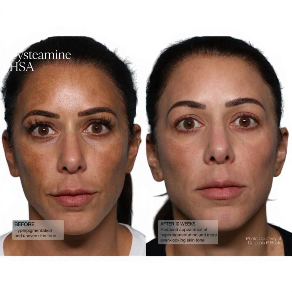 Senté Pigment and Tone Correcting Mask