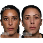 Senté Pigment and Tone Correcting Mask