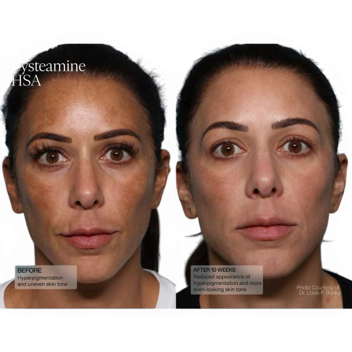 Senté Pigment and Tone Correcting Mask