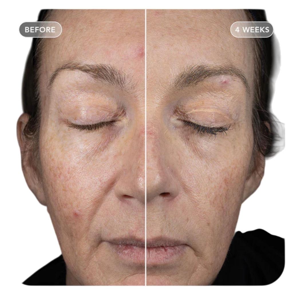 IMAGE Skincare VOL.U.LIFT GLP-1 4D Skin Rebound Complex