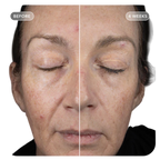 IMAGE Skincare VOL.U.LIFT GLP-1 4D Skin Rebound Complex