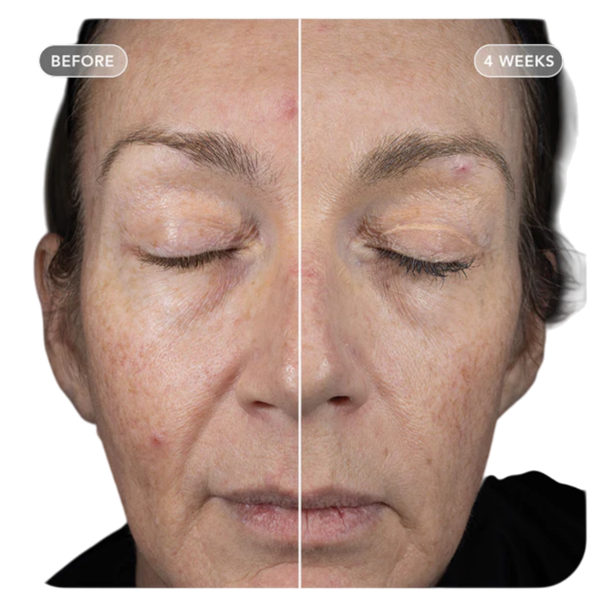 IMAGE Skincare VOL.U.LIFT GLP-1 4D Skin Rebound Complex