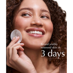 Exuviance Performance Peel AP25 At-Home Chemical Peel
