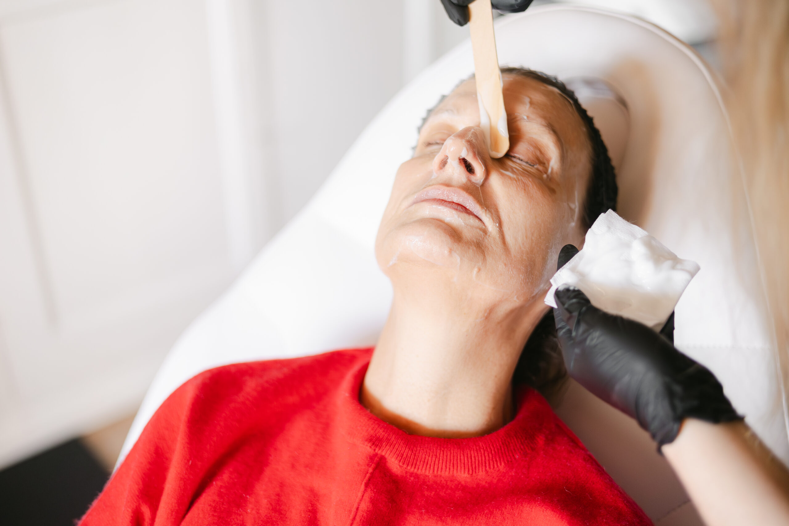Rosacea versus acne skin consultation at Face for Soul, Burford, Oxfordshire