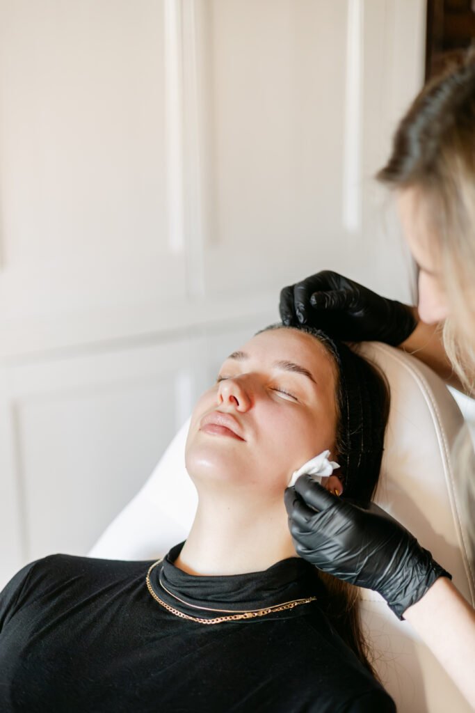 Rosacea treatment consultation and sessions at Face for Soul, Burford, Oxfordshire
